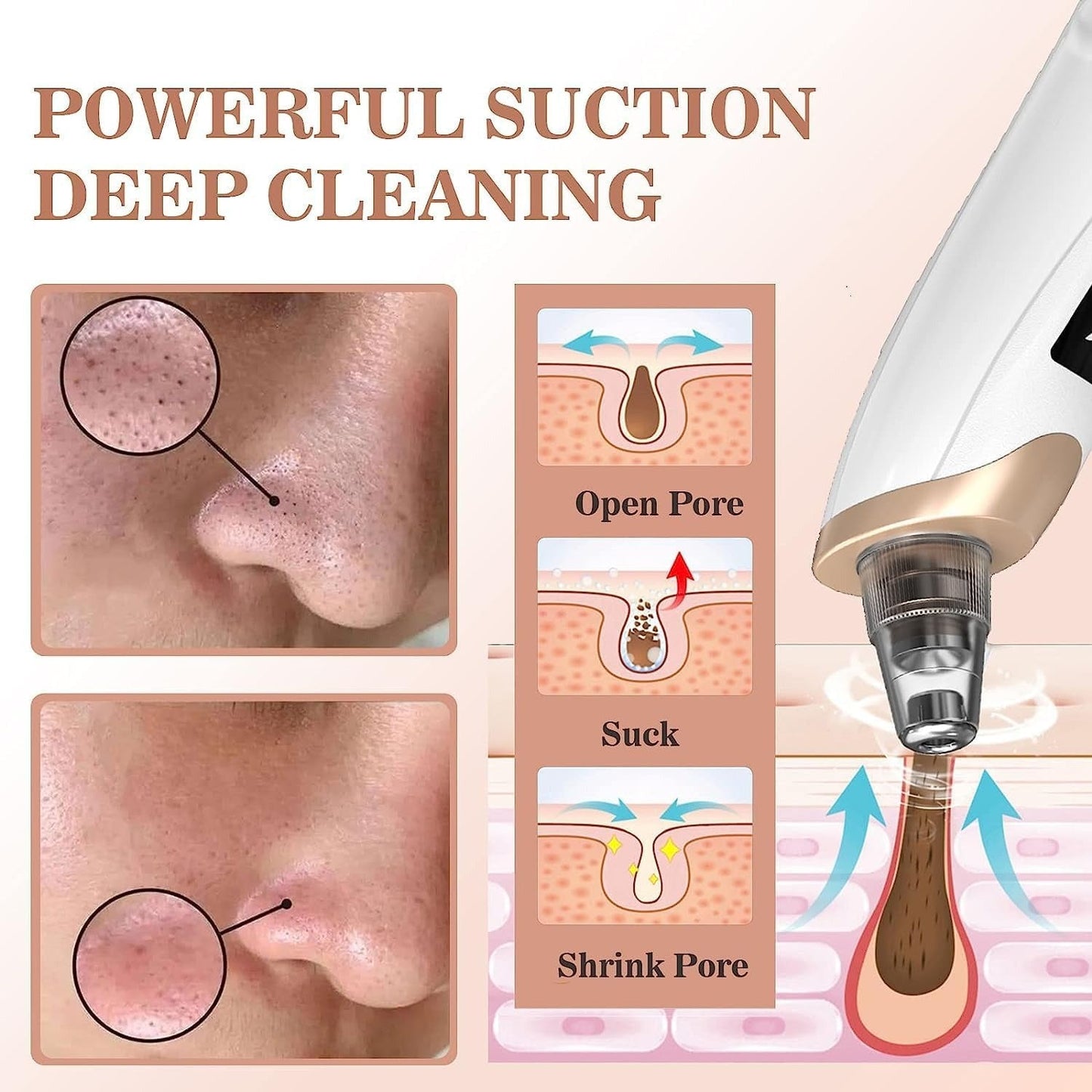 Electric Blackhead Remover Vacuum – Pore Cleaner with Multi-Level Suction