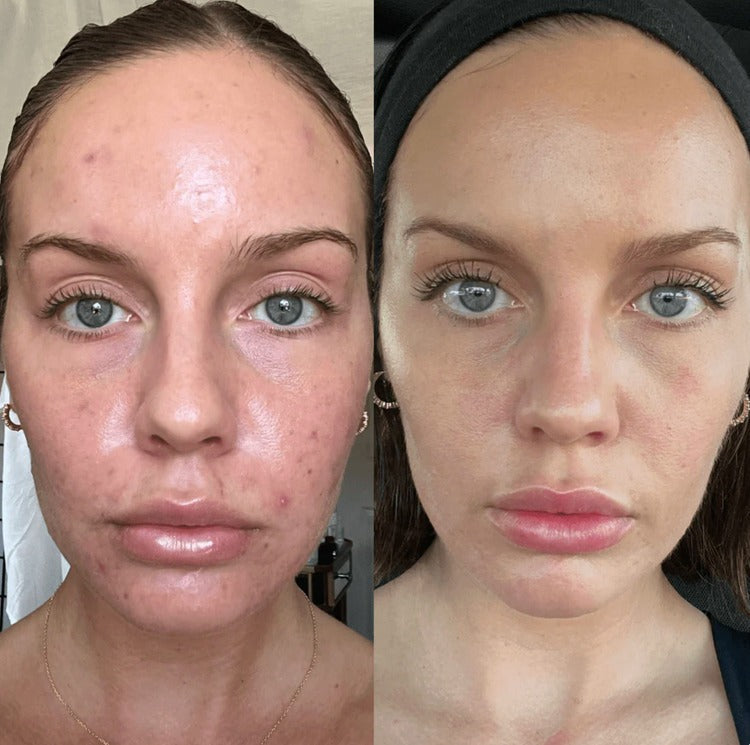 Orange Enzyme Exfoliating Gel – Smooth, Bright & Glowing Skin