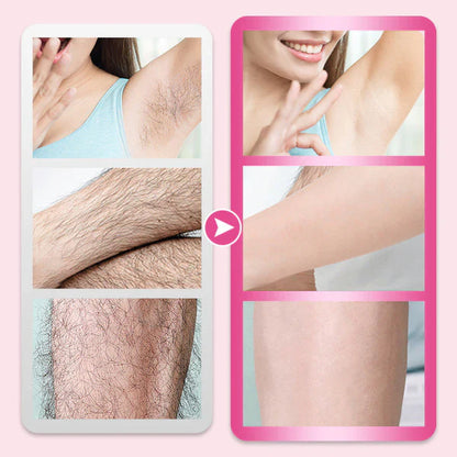 Gentle Hair Removal Cream – Smooth Skin Without the Pain